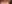 眼瞼下垂手術（目つき矯正） — アーバン美容外科クリニック