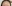 額縮小術（生え際下げ・ヘアライン下降術） — バタン美容外科クリニック