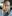 Facial fat grafting (autologous fat transfer to the face) — Pleasure Plastic Surgery Clinic