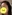 Scalp hair transplant — Mo&Line Plastic Surgery
