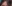 額（おでこ）のヒアルロン酸注入 — ドレス美容外科クリニック