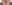 Lip filler (lip augmentation with HA) — Maison de M Clinic