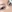 buried suture (non-incisional) double eyelid surgery — Yellow Plastic Surgery Clinic