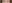 裏ハムラ法（経結膜的眼窩脂肪移動術） — ハッシュ美容外科クリニック