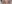 額リフト（前額リフト） — ヒート美容外科クリニック