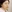 鼻尖形成術（自家軟骨移植） — マスト美容外科クリニック