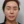 Ultraformer MPT (อัลตร้าฟอร์เมอร์ เอ็มพีที) — หลังทำ · เจฟิลคลินิก-สาขากังนัม
