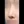 revision rhinoplasty — before (7days) · Anersty Plastic Surgery Clinic