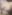 豊胸術（シリコンインプラント／人工乳腺） — エイト美容外科クリニック