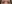 裏ハムラ法（経結膜的眼窩脂肪移動術） — チャイ美容外科
