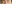 裏ハムラ法（経結膜的眼窩脂肪移動術） — SM美容外科クリニック