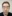 Masseter Botox (jaw slimming / square jaw reduction) — Uline Clinic