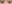 二重まぶた（自然癒着法） — コディ美容外科クリニック