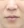 Chemical peel — after (21days) · J.Fill Clinic - Gangnam Branch
