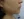 เลเซอร์ Fraxel (Fractional Laser) — ก่อนทำ (7วัน) · คลินิก Le Shine