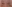 Lower Eyelid Fat Repositioning (transconjunctival) — Il Gong Gong Plastic Surgery Clinic