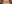 Ptosis Correction (levator surgery / eye-shape correction) — Urban Plastic Surgery Clinic