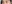 二重まぶた（自然癒着法） — プロミス美容外科クリニック