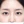 ลบรอยสักคิ้ว (ลบคิ้วกึ่งถาวร) — ก่อนทำ (7วัน) · คลินิก Apgujeong Beauty & Me