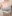 豊胸術（シリコンインプラント／人工乳腺） — ライアン美容外科クリニック