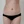 Back liposuction — before (13days) · Hourglass Clinic