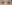 buried suture (non-incisional) double eyelid surgery — Hershey Plastic Surgery Clinic