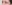 二重まぶた（自然癒着法） — イエロー美容外科クリニック