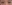 裏ハムラ法（経結膜的眼窩脂肪移動術） — プレジャー美容外科クリニック