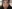 Lower Eyelid Fat Repositioning (transconjunctival) — Pleasure Plastic Surgery Clinic