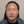 Belotero Revive (HA + glycerol skinbooster) — before (10days) · Ripain Clinic