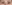二重まぶた（自然癒着法） — フルルン美容外科クリニック