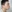 Bulbous nose correction (surgical nasal tip reduction) — R&B Plastic Surgery Clinic