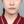 輪郭形成の修正手術（再手術） — 術前 (30日) · D.A.美容外科クリニック