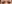 二重まぶた（自然癒着法） — プロミス美容外科クリニック