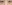 裏ハムラ法（経結膜的眼窩脂肪移動術） — ファクト美容外科クリニック