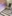 唇のヒアルロン酸注入（リップヒアルロン酸） — ドレス美容外科クリニック