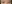 裏ハムラ法（経結膜的眼窩脂肪移動術） — ハッシュ美容外科クリニック