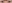 二重まぶた（自然癒着法） — フルルン美容外科クリニック