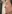 糸リフト（スレッドリフト） — ミケイ美容外科