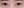 ผ่าตัดแก้ขนตาทิ่มตา (ขนตาแยงตา / เปลือกตาม้วนเข้า) — หลังทำ (60วัน) · ชาอีศัลยกรรม