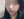 顴骨肉毒桿菌注射 — 術前 (7天) · U-Line醫美診所