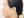 Ultherapy (Ulthera) micro-focused ultrasound lift — after · Monster Clinic