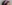 唇のヒアルロン酸注入（リップヒアルロン酸） — ロリポップ美容外科クリニック