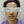 Upper Lip Laser Hair Removal — before (121days) · Beauty Blossom Clinic