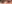 下眼瞼下制術（グラマラスライン形成・たれ目形成） — フルルン美容外科クリニック