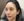 Ultracol (PDO microsphere collagen stimulator injection) — before · Mochi Clinic