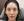 Ultracol (PDO microsphere collagen stimulator injection) — before · Mochi Clinic