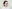 Bulbous nose correction (surgical nasal tip reduction) — Uri Plastic Surgery Clinic