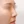 Nose tip filler — before · Erne Clinic