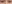 裏ハムラ法（経結膜的眼窩脂肪移動術） — ファクト美容外科クリニック